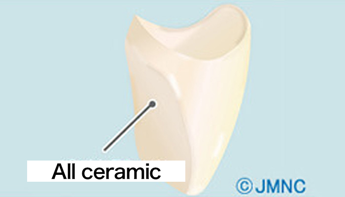 Ceramic Crown