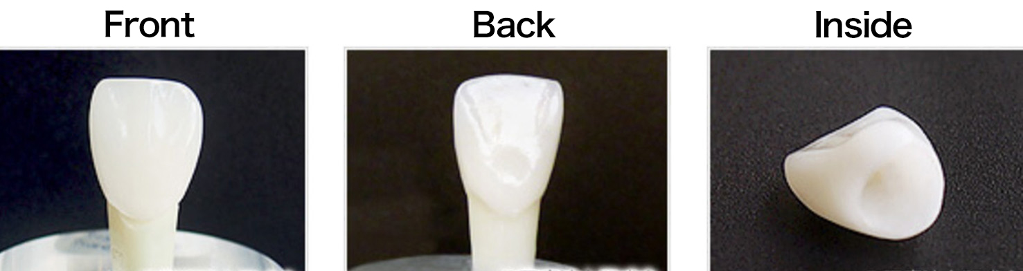 All-ceramic