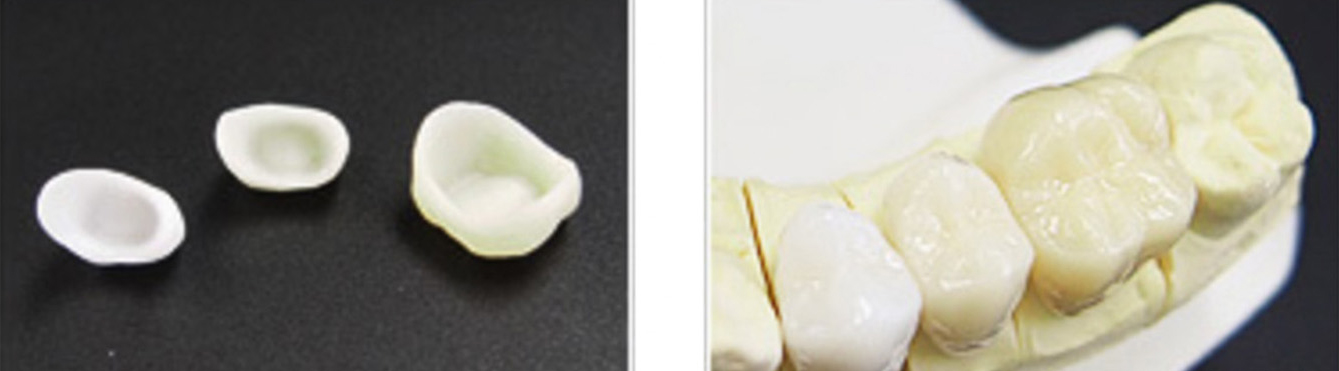 Single color zirconia